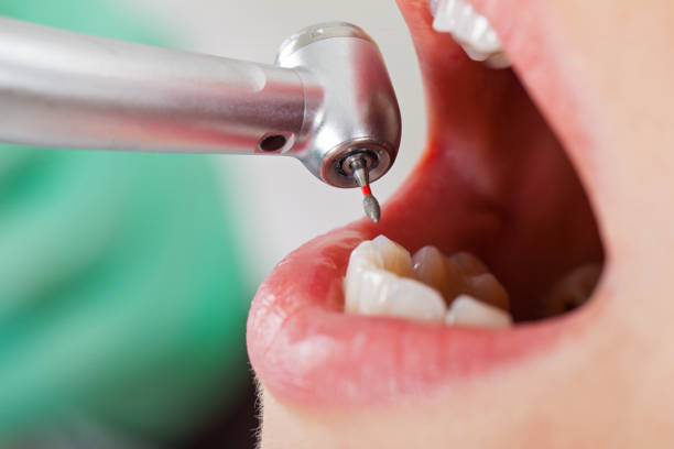 Best Walk-In Emergency Dentist in Manning, SC